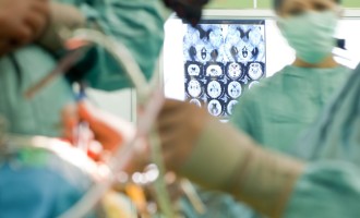 Cirurgia pode livrar 600 mil brasileiros das crises epilépticas