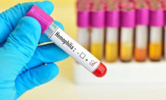Hemofilia: entenda a doença que dificulta a coagulação