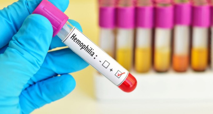 Hemofilia: entenda a doença que dificulta a coagulação