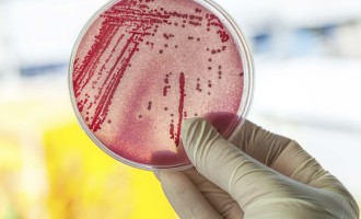 Bactéria resistente a antibióticos e transmitida sexualmente assusta especialistas