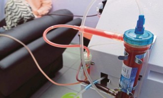 CFM define a ozonioterapia como prática experimental no País