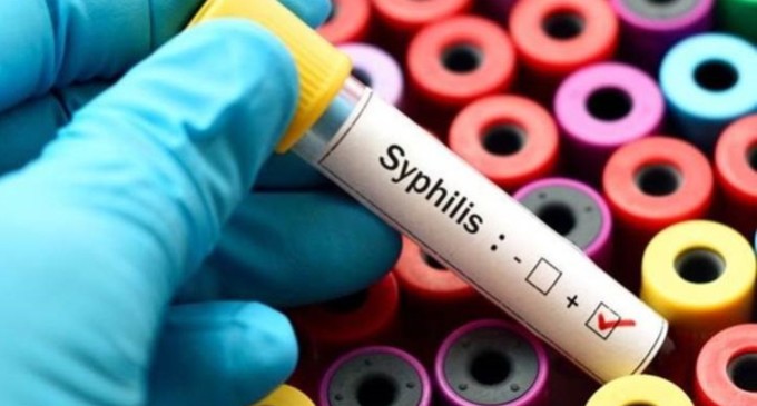 Aumento de casos de sífilis preocupa médicos