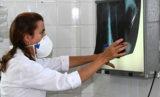 Brasil registra 78 mil novos casos de tuberculose no ano passado