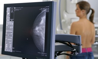 Oito milhões de mulheres em idade de risco de câncer moram em cidades sem mamógrafos