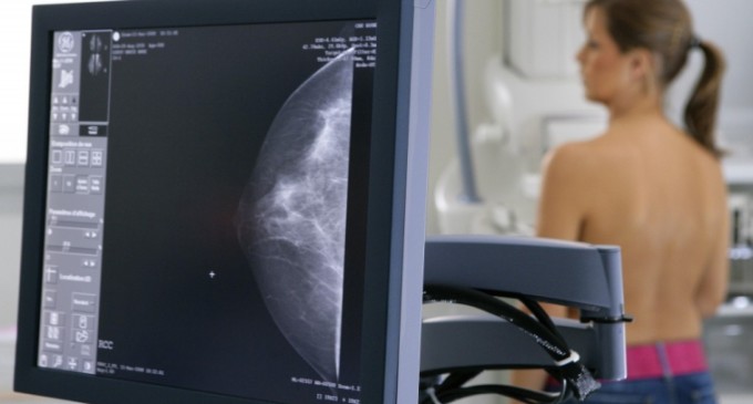 Oito milhões de mulheres em idade de risco de câncer moram em cidades sem mamógrafos