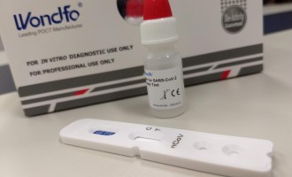 Testes rápidos para auxílio diagnóstico da Covid-19 chegam ao Rio Grande do Sul