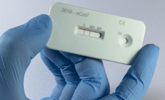 Testes para Covid-19 aumentam 23,4% em Pelotas