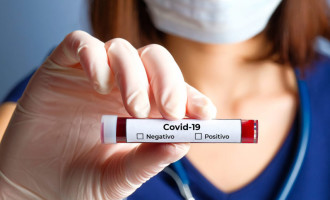 COVID-19 : Pelotas registra a 18ª morte  e confirma 52 novos casos