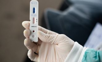 Pelotas ultrapassa aplicação de 75 mil testes para o coronavírus