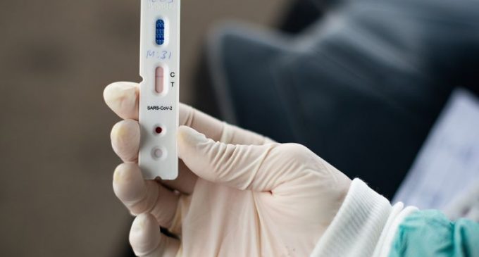 Pelotas ultrapassa aplicação de 75 mil testes para o coronavírus