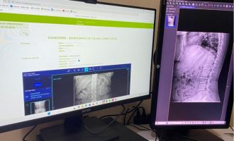 HE-UFPel inicia a utilização do Sistema de Telemedicina e Telessaúde (STT)