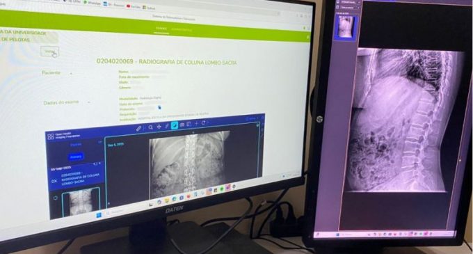 HE-UFPel inicia a utilização do Sistema de Telemedicina e Telessaúde (STT)