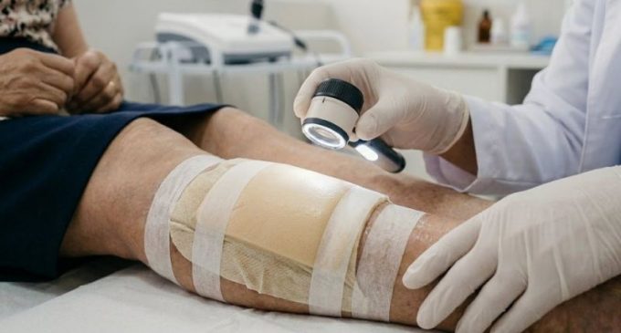 Pronto-Socorro de Pelotas possui atendimento especializado para pacientes com lesões de pele