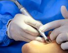 UBS CAIC Pestano retoma atendimentos odontológicos